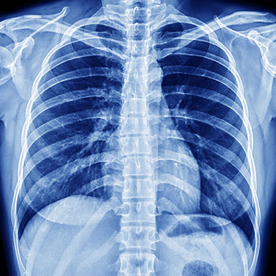 Digital-Radiography-home-page-photo